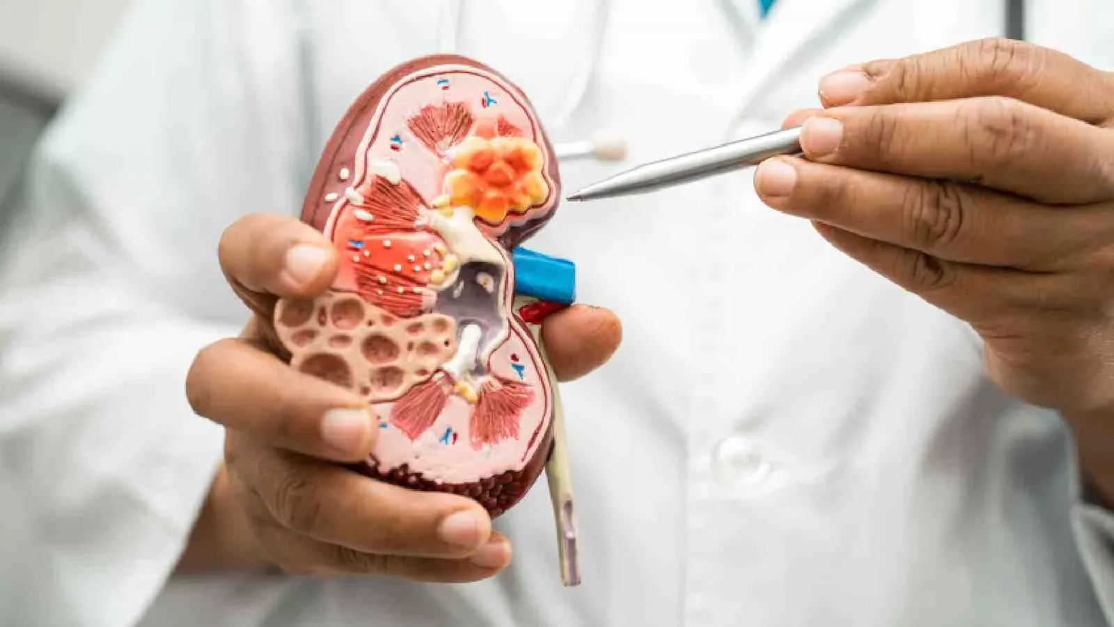 Doctor holding kidney model